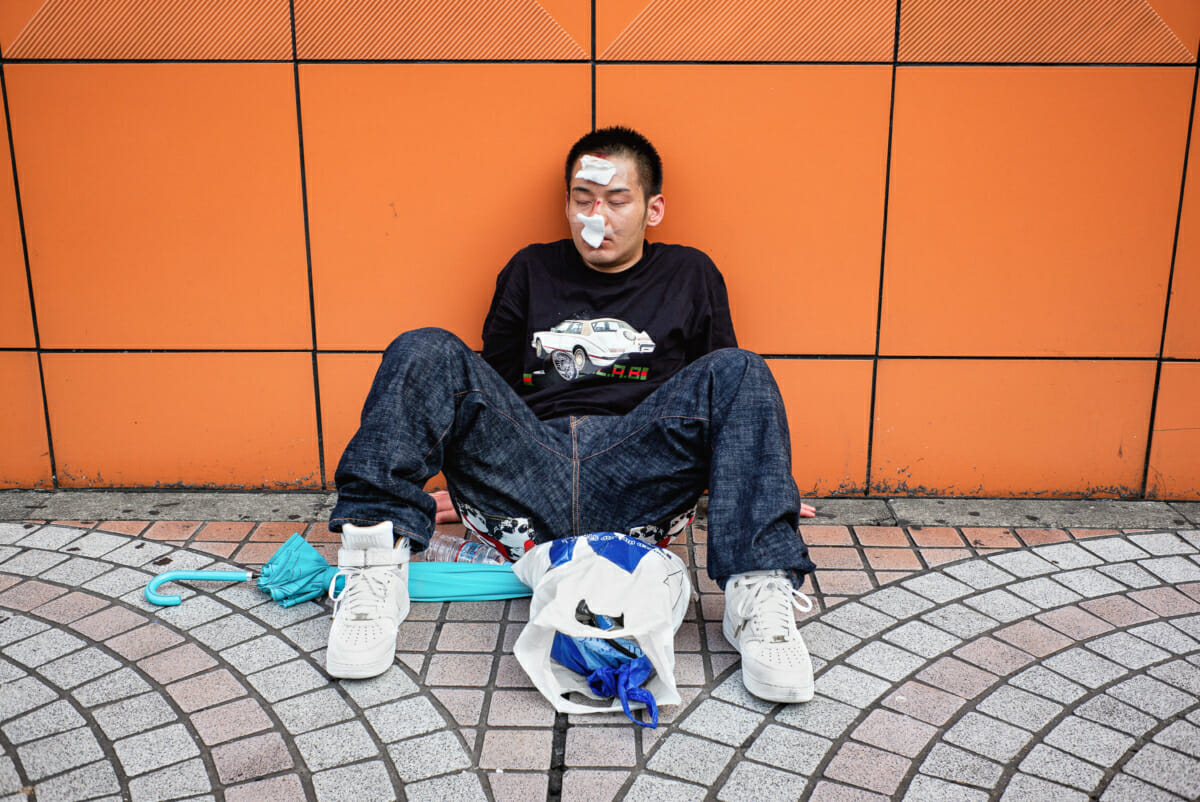 a battered and bruised young Japanese man in Tokyo